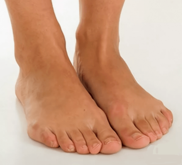 Zdrave noge po zdravljenju s pršilom Hondrox