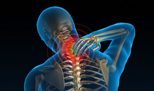 bolečine v vratni hrbtenici z osteohondrozo