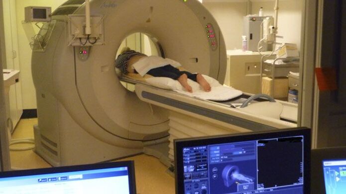 MRI hrbtenice za diagnosticiranje bolečine v hrbtu