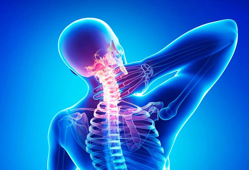 Osteohondroza hrbtenice je pogosta bolezen, ki zahteva zdravljenje. 