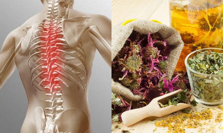 Tradicionalni recepti - preprečevanje razvoja osteohondroze in podpiranje zdravja hrbtenice