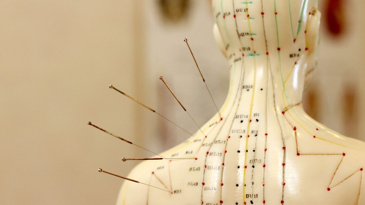 akupunktura za cervikalno osteohondrozo