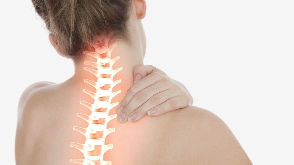 Osteohondroza regije materničnega vratu